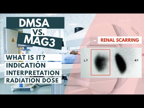 Видео: Сравнение сканирования DMSA и MAG3 | Ядерная медицина | Подробный обзор