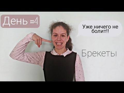 Видео: Железная неделя/ брекеты день #4