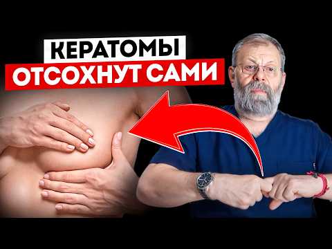 Видео: 1 упражнение от кератом за 5 секунд