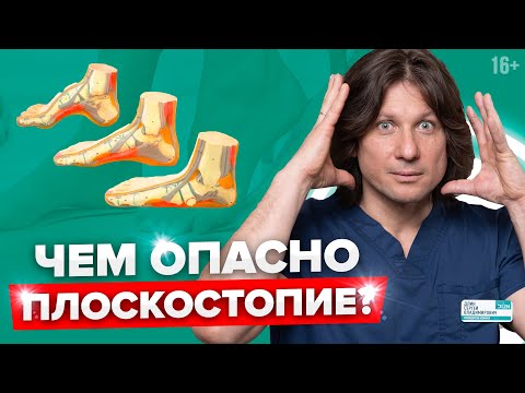 Видео: Страшные последствия плоскостопия! Как определить плоскостопие в домашних условиях?