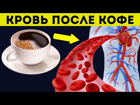 Видео: Вот она - ПРАВДА! Что кофе творит с кровью и организмом даже одна чашка?