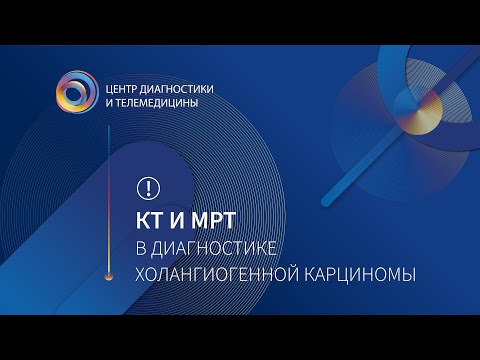 Видео: КТ и МРТ в диагностике холангиогенной карциномы