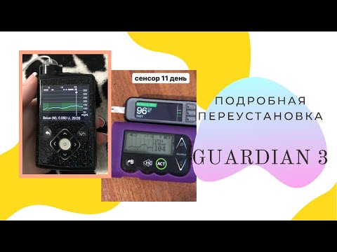 Видео: ПОЛНАЯ ПОДРОБНАЯ ПЕРЕУСТАНОВКА СЕНСОРА GUARDIAN 3/ ENLITE