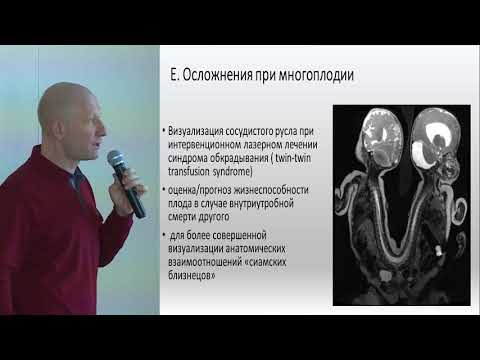 Видео: МРТ в диагностике патологии плода и плаценты