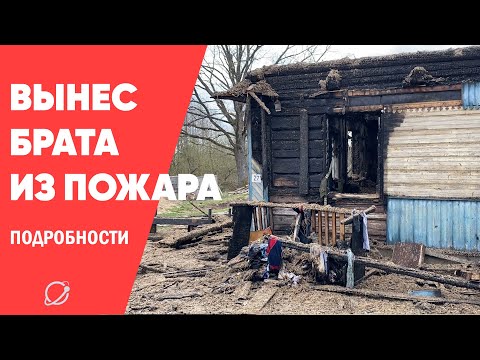 Видео: Рому, который вынес из пожара младшего брата, будут спасать в Минске