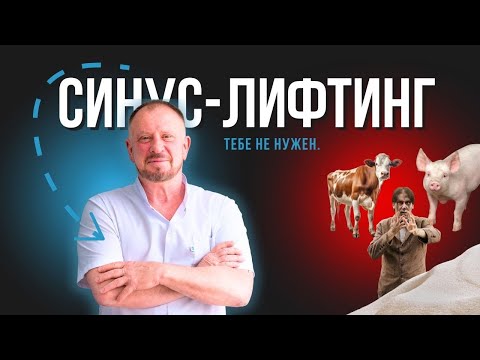 Видео: Синус-Лифтинг. Тебе не нужен. #докторосадчий #стоматологиякиев #стоматология