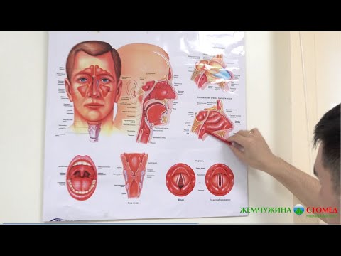 Видео: Отит: от чего он возникает и как его лечить?