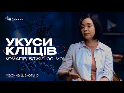 Видео: Укуси кліщів, бджіл, ос, комарів: перша допомога та алгоритм дій | Педіатр Марина Шакотько