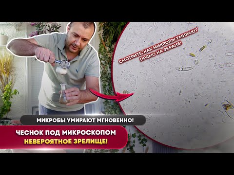 Видео: Что чеснок делает с микробами под микроскопом 😱 Мгновенная смерть!