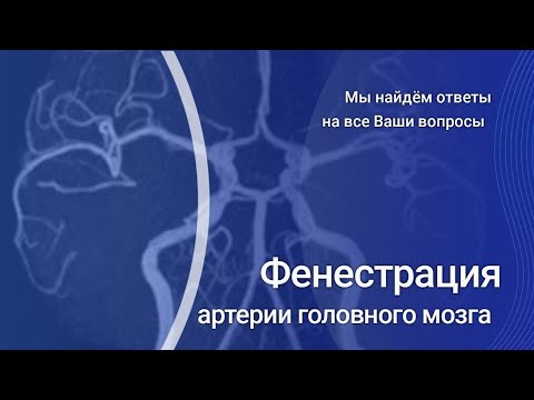 Видео: Фенестрация артерии головного мозга