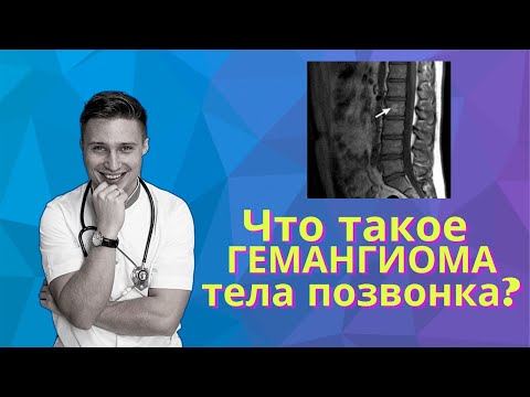 Видео: ГЕМАНГИОМА тела позвонка: что это такое?