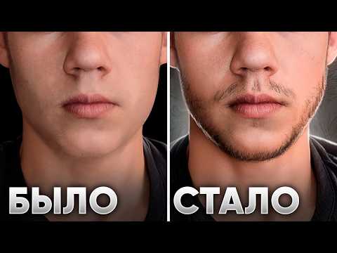 Видео: В 17 ЛЕТ ЗАПУСТИЛ РОСТ БОРОДЫ С НУЛЯ / РЕЗУЛЬТАТЫ XINOXIN