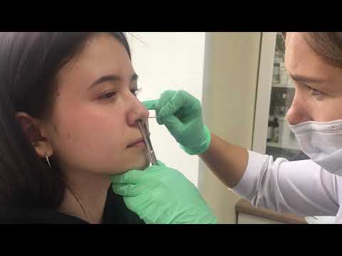 Видео: Прокол носа