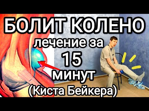 Видео: Болит колено! Лечение за 15 минут - КИСТА БЕЙКЕРА(Беккера)