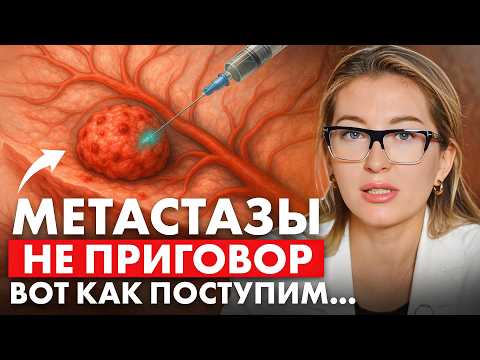 Видео: Рак дал МЕТАСТАЗЫ. Что это и можно ли ИЗЛЕЧИТЬ? // #онкологМочалова