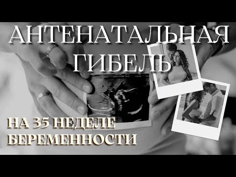 Видео: АНТЕНАТАЛЬНАЯ ГИБЕЛЬ НА 35 НЕДЕЛЕ БЕРЕМЕННОСТИ | ИСТОРИЯ МОЕЙ 3 БЕРЕМЕННОСТИ 
