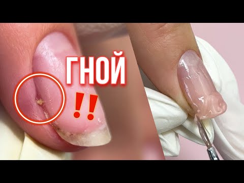 Видео: Чего так сложно 🤕 УКРЕПЛЕНИЕ ногтей ГЕЛЕМ ЖЕЛЕ. Маникюр и ПАНАРИЦИЙ ‼️