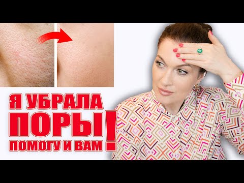 Видео: Убрала расширенные поры! Помогу и вам! Работающие решения💥, никакой "воды"💦!