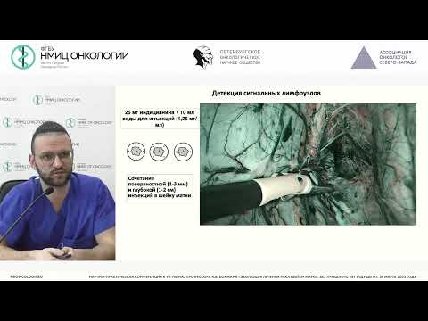 Видео: Детекция сигнальных лимфатических узлов при раке шейки матки