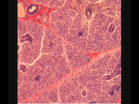 Видео: ОКОЛОУШНАЯ ЖЕЛЕЗА. PAROTID GLAND. В световой микроскоп.