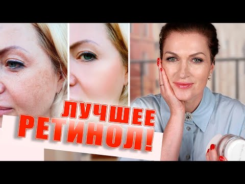 Видео: Убираем морщины и пигментацию! Ретинол: кремы, сыворотка лучшее!