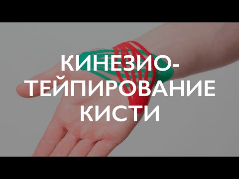 Видео: Кинезиотейпирование кисти | Реабилитация кисти