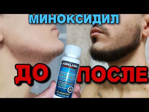 Видео: Как я отрастил бороду с нуля | Миноксидил, моя история
