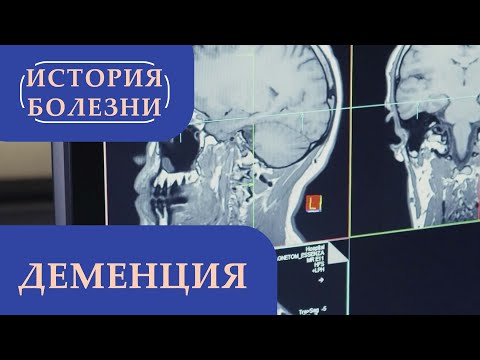 Видео: Деменция | «История болезни»