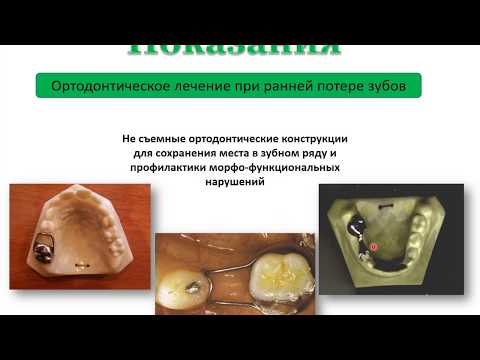 Видео: Стандартные защитные коронки в детской стоматологии