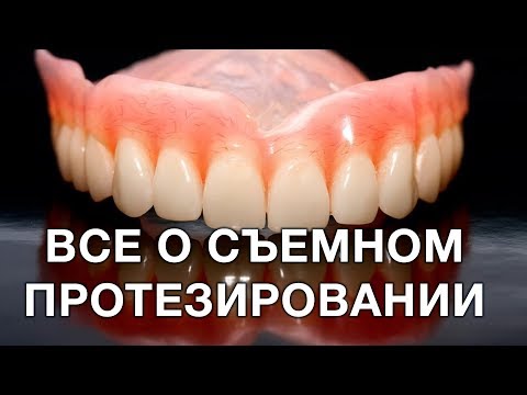 Видео: Cъемное протезирование. Что такое съемные протезы? В каких случаях используют протезирование?