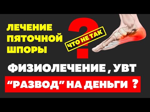 Видео: Как лечить пяточные шпоры. Самое понятное видео о лечении боли в пятках.