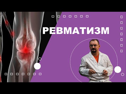 Видео: Ревматизм. Его причины и лечение.
