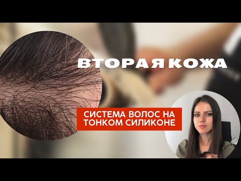 Видео: Самая незаметная мужская система волос - такое рука не поднимется назвать париком 😀