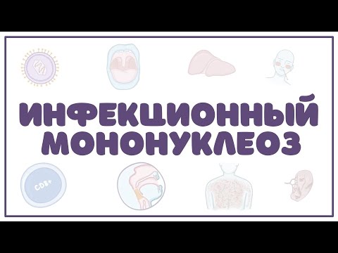 Видео: Инфекционный мононуклеоз (клиника, диагностика, лечение) лекция