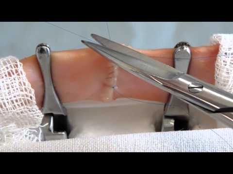 Видео: Сосудистый шов Карреля