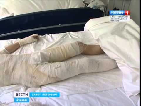 Видео: Женя Михневич, 8 лет, термический ожог II–III степени