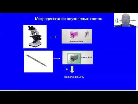 Видео: Сложные вопросы молекулярной диагностики меланомы
