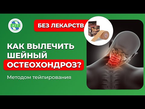 Видео: ✅Шейный остеохондроз | Тейпирование при боли в шее