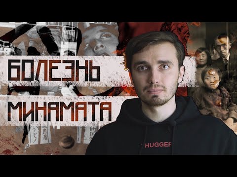 Видео: Болезнь Минамата: Фабрика смерти в Японии