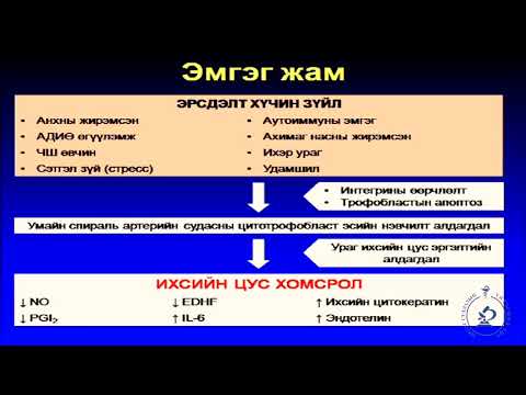 Видео: 6 Манас таталтын урьдал, манас таталтын эмгэг судлалын оношлогоо