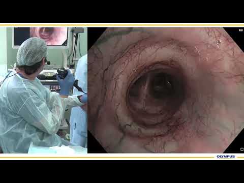 Видео: Туберкулез ВГЛУ. И. В. Сивокозов, Я. О. Чесалина