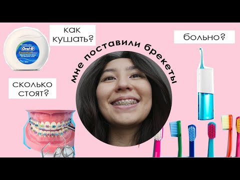 Видео: Я ПОСТАВИЛА БРЕКЕТЫ | вся правда о брекетах и реакция родных