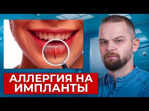 Видео: Аллергия в стоматологии. Узнай это прежде чем начнешь лечение!