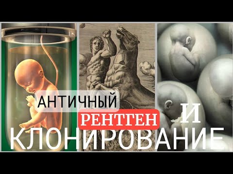 Видео: Сказания о Титанах: супергерои-великаны Афариды и рентгенолог Линкей