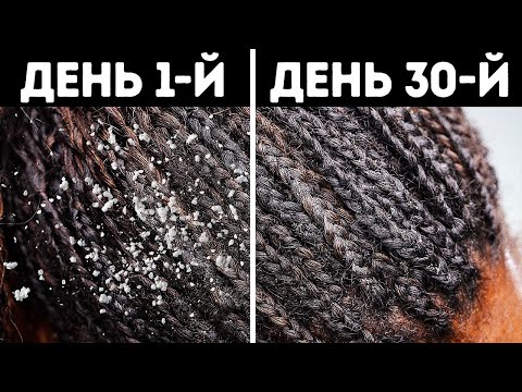 Видео: 10+ натуральных способов избавиться от перхоти, не выходя из дома