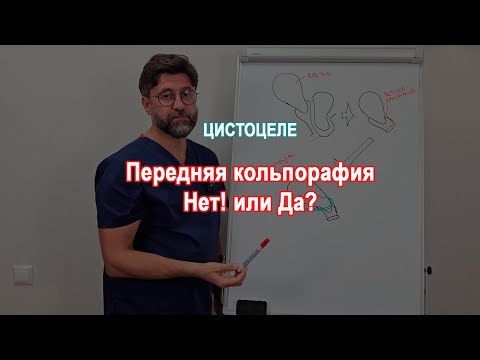 Видео: Передняя кольпорафия при цистоцеле - плохой выбор!?