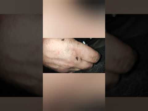 Видео: Чистка дренажа Renault Kangoo 2. Кенго 2 дренаж кондиционера.Забит дренаж Renault Kango2.Кондиционер