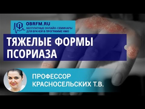 Видео: Профессор Красносельских Т.В.: Тяжелые формы псориаза