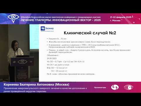 Видео: Применение микроимпульсного лазерного лечения глаукомы