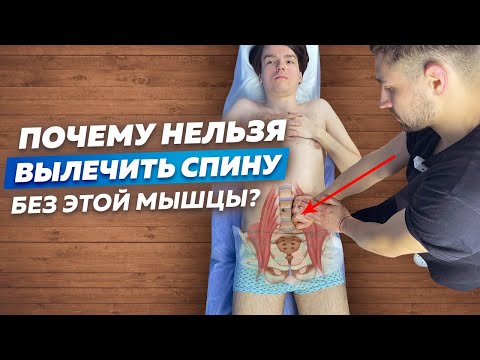Видео: Подвздошно-Поясничная Мышца. ТАЙНА БОЛЕЙ В СПИНЕ!